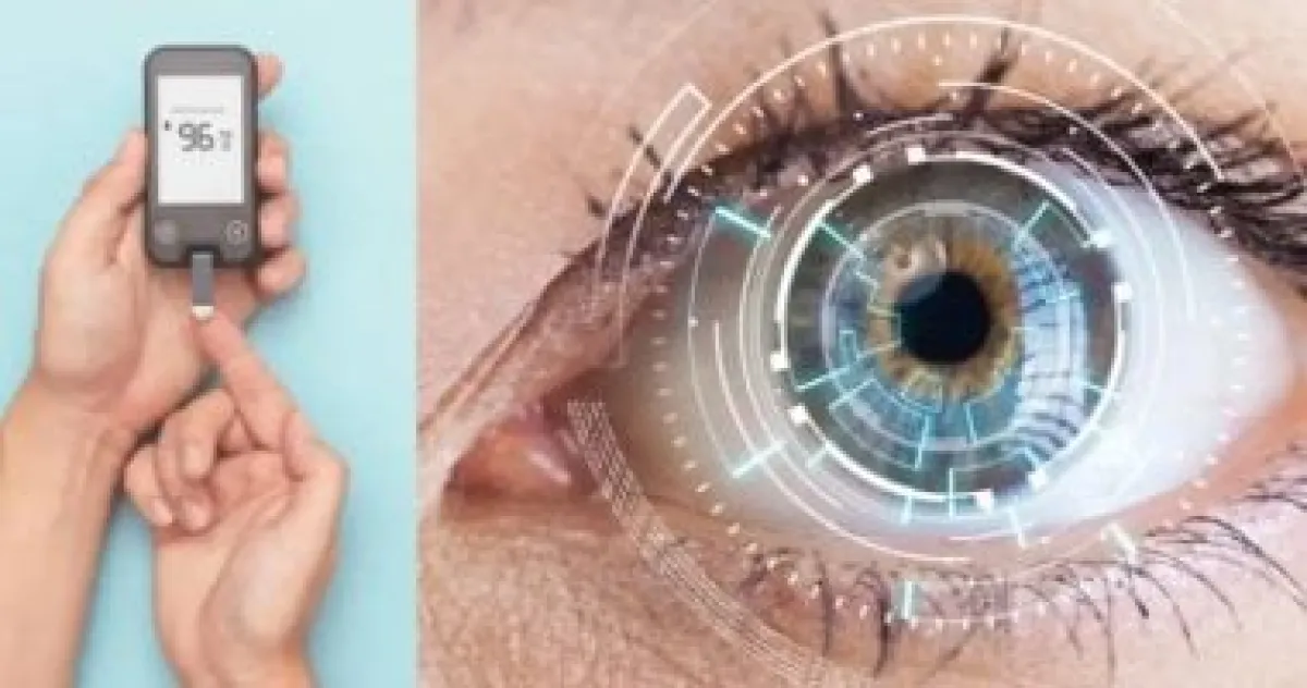 ثورة تقنية: الذكاء الاصطناعي يكشف السكري بدقة 95% من صورة عين واحدة