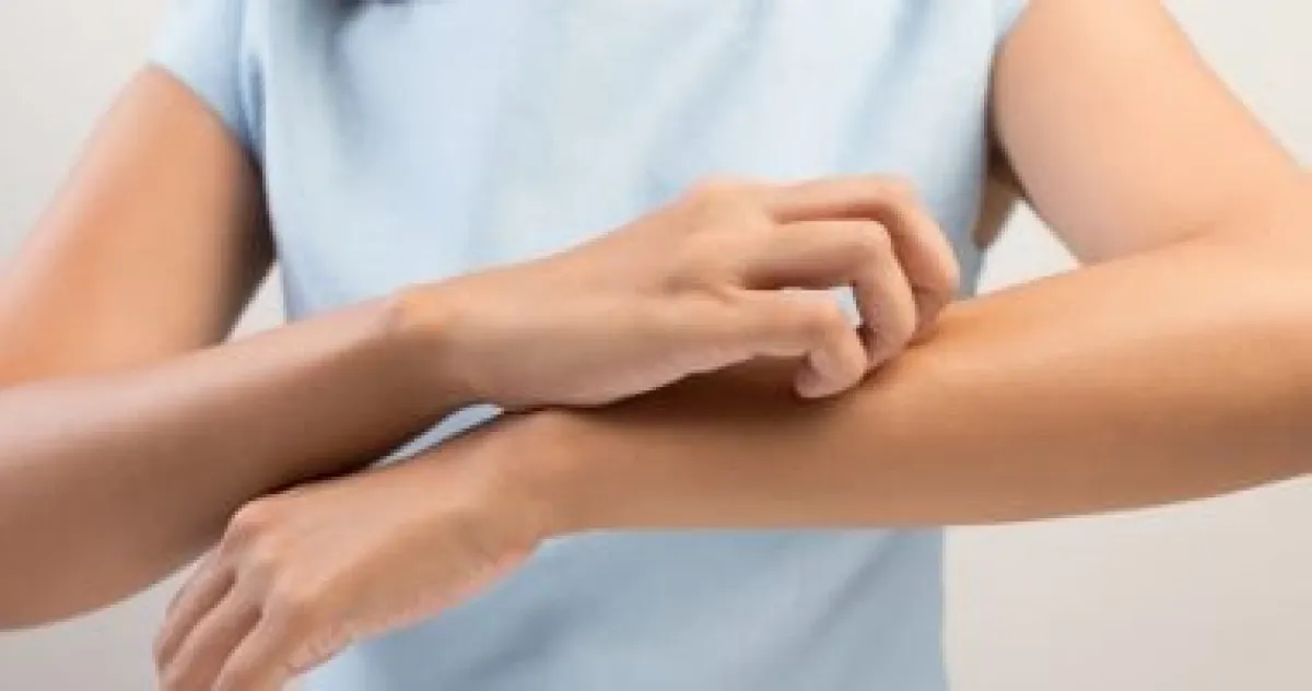 حساسية الطعام: 5 علامات تحذيرية مبكرة لا يجب الاستهانة بها