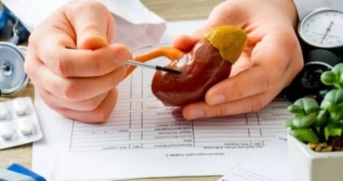 حصوات الكلى: دليلك الشامل لأبرز 5 أسئلة حول الأعراض والمضاعفات