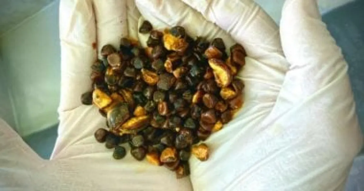 حصى مرارة البقر تتفوق على الذهب: أغلى من المعدن الثمين لأسباب طبية